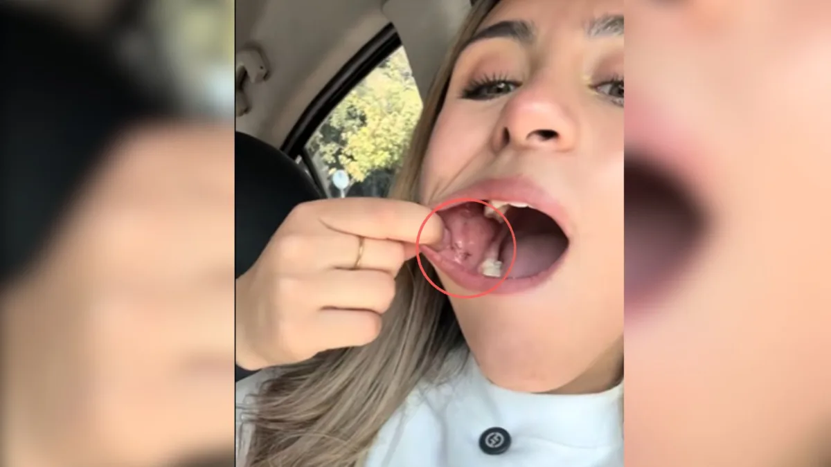 ¿Se comería un taco de tarántula? Joven lo hizo y se le incrustaron los pelos 2 ¿Se comería un taco de tarántula? Joven lo hizo y se le incrustaron los pelos Una joven fue a un mercado y probó unos tacos de tarántula. Después del primer bocado se le incrustaron los pelos del animal en el cachete y se le durmió la zona.